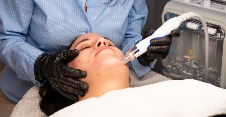Fruchtsäure Peeling zur Hautbildverbesserung Nürnberg Nordstadt