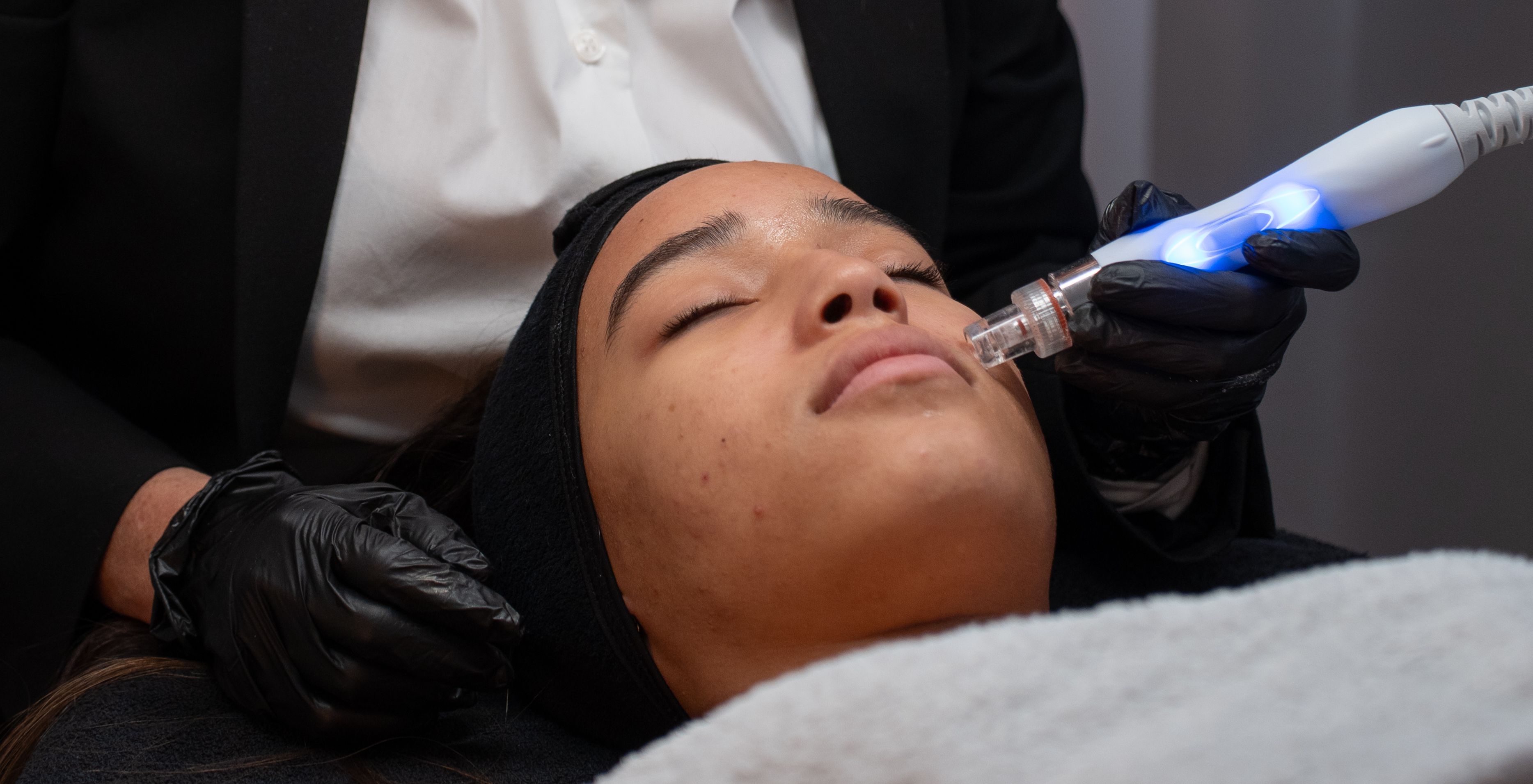 Fruchtsäure Peeling zur Hautbildverbesserung Nürnberg Nordstadt